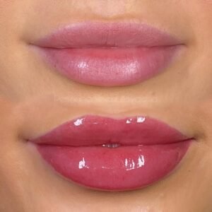 864a26c2 e25e 4ae0 ba79 ed815ec5ba9b